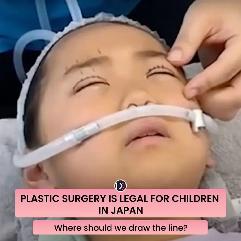 **Plastic Surgery for Minors in Japan: …