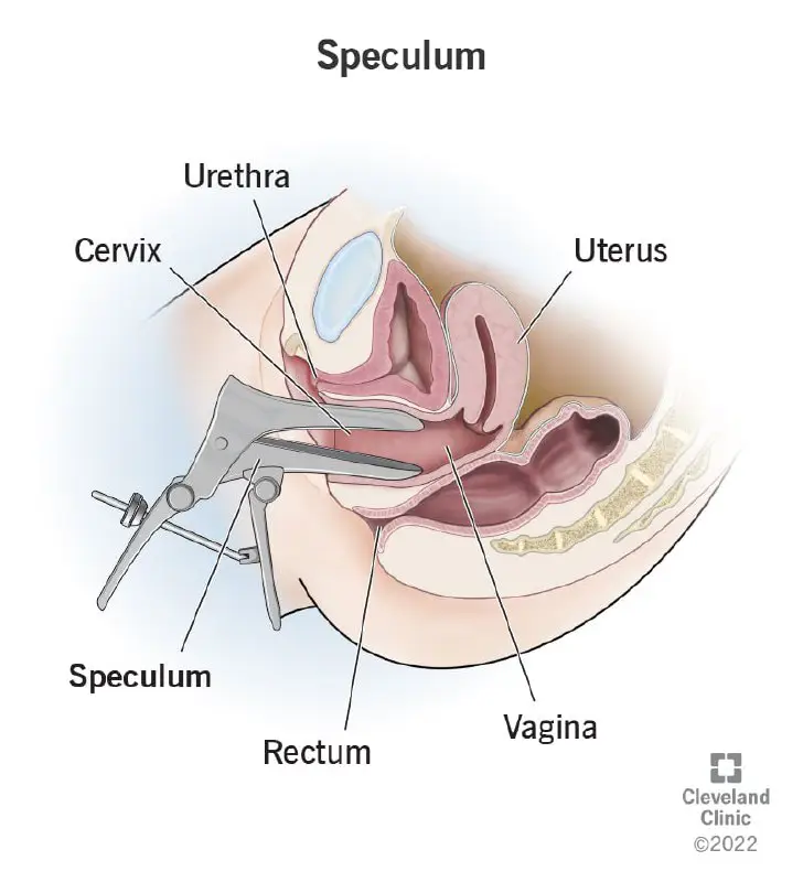 **YSK: YOU CAN ASK YOUR DOCTOR TO USE A NARROW SPECULUM**