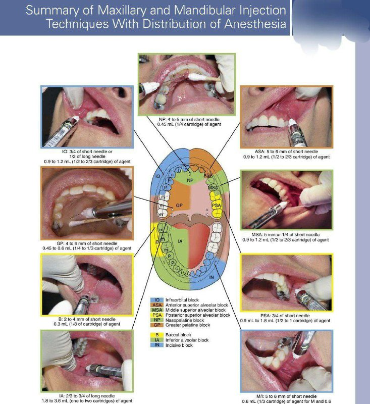 ***?******♨️***[يسعد مـــــساااكم /](https://t.me/Dentist_Mohamed_Almhzafi)