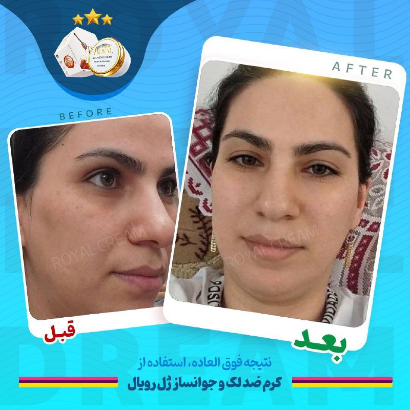 ***?******?***مناسب هر مشکل پوستی محصول مراقبتی …