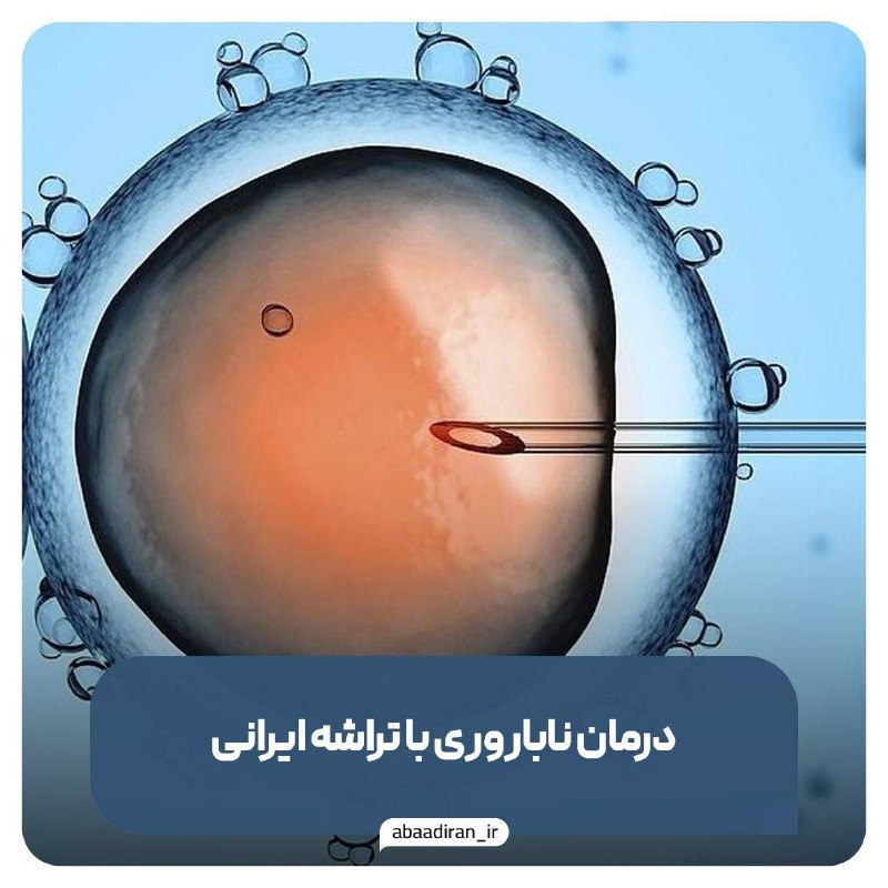 *درمان ناباروری با تراشه ایرانی*