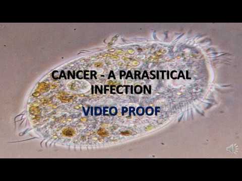 VIDEO PROOF: CANCER IS CAUSED BY …