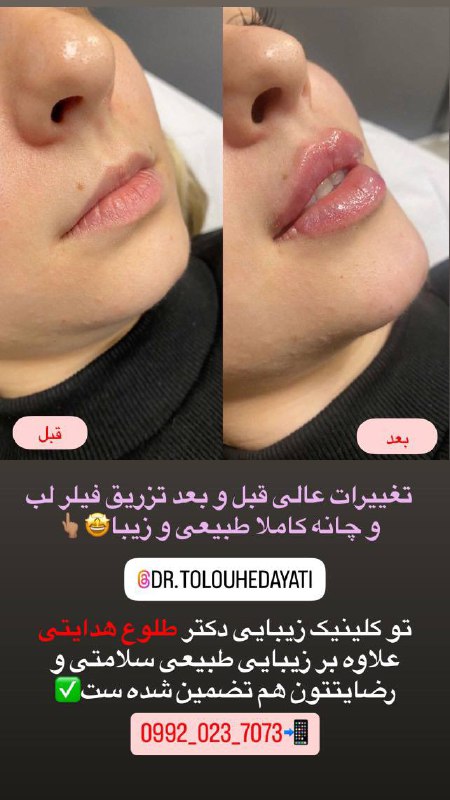 ***❌***اكه دنبال يه