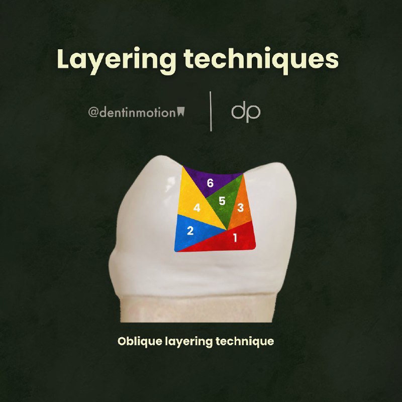 layering techniques of composite restoration.