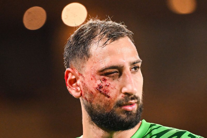 ***🚨*** **Gianluigi Donnarumma devrait être forfait …