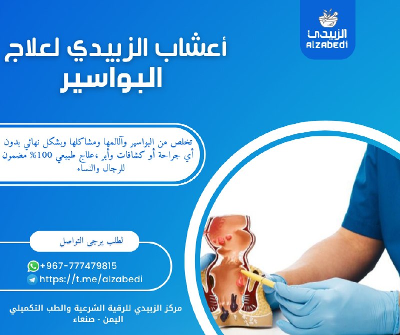 اعشاب الزبيدي لعلاج البواسير