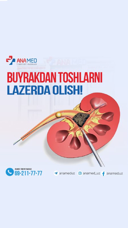 **ANAMED tibbiyot markazida Siydik tosh kasalligini …