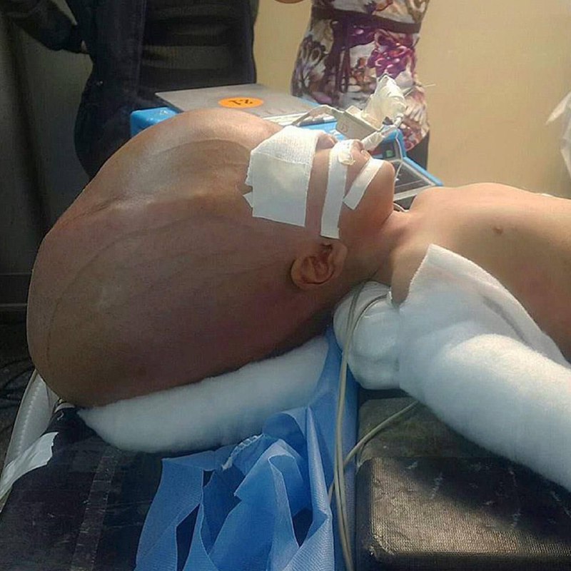 Clinical example of a child with …