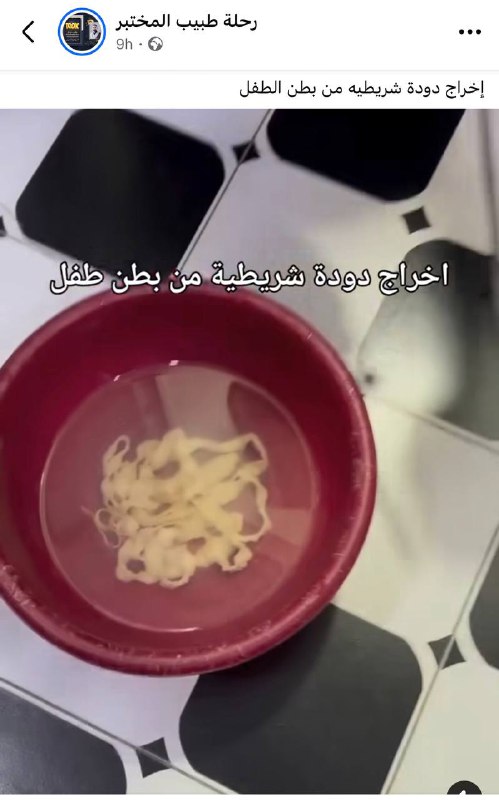 أعراض الإصابة بالديدان الشريطية