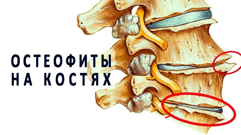 Прежде, чем искать психологическую причину панической …