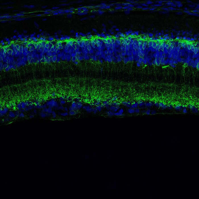 Una molecola italiana risveglia i neuroni …