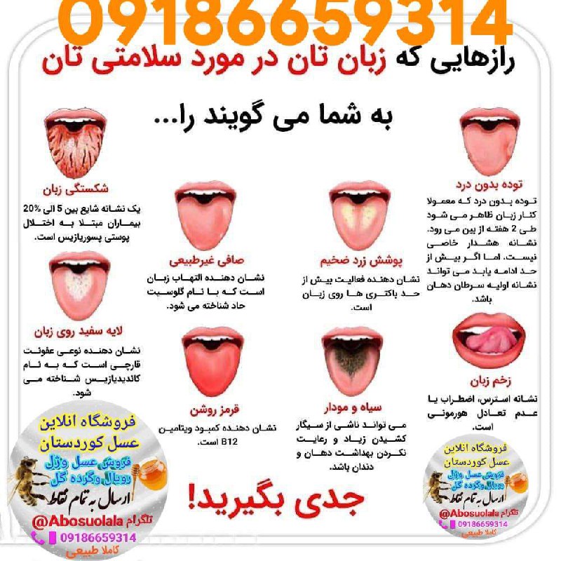 رازهایی که زبانتان درموردسلامتی شمامیگه