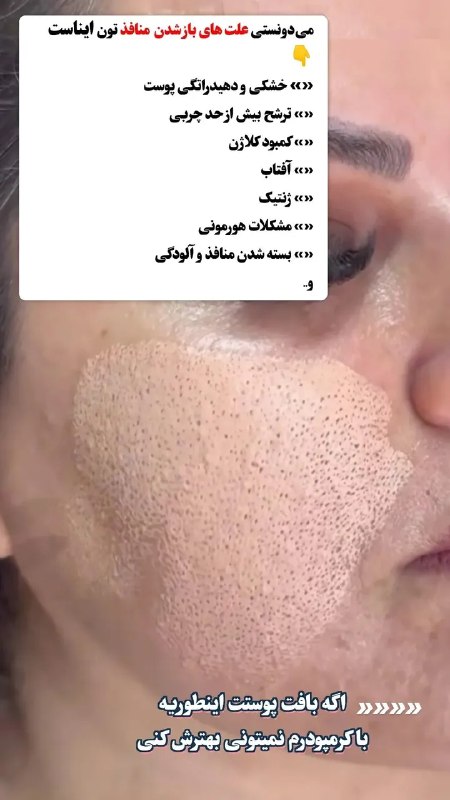 ***💚***میدونستی علت‌های بازشدن [#منافذتون](?q=%23%D9%85%D9%86%D8%A7%D9%81%D8%B0%D8%AA%D9%88%D9%86) اینان***‼️***