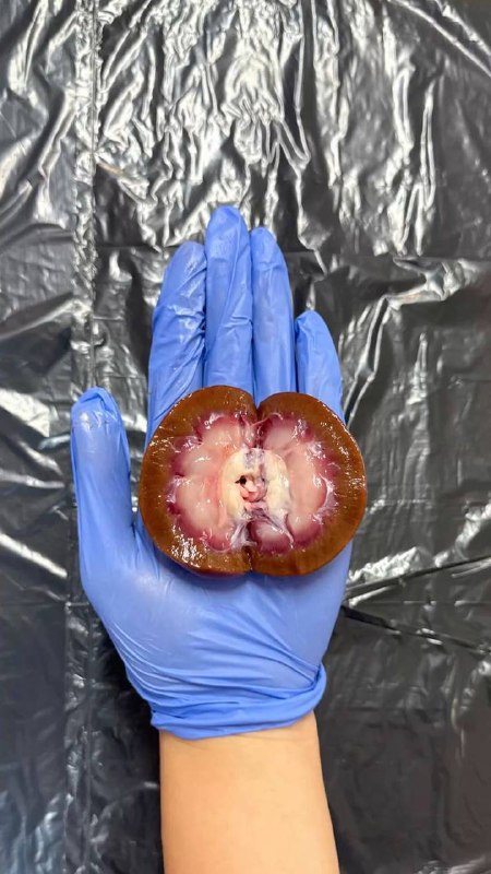 Kidney