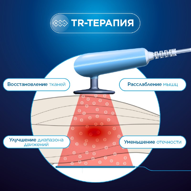 ***🔍*** [TR-терапия](https://www.btlmed.ru/products-physiotherapy-targeted-radiofrequency-therapy): новаторское решение для снятия …