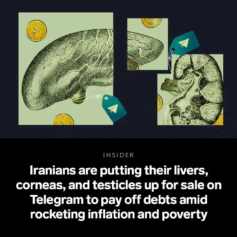 ***🫁*** As Iran grapples with rocketing …