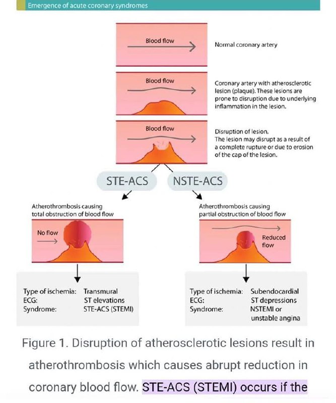 Cardiology