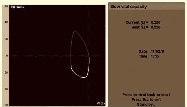 [‍](https://attach.fahares.com/QydhFC+H1UdBbW13diRqbQ==) ‍ ***4⃣*** Slow Vital Capacity