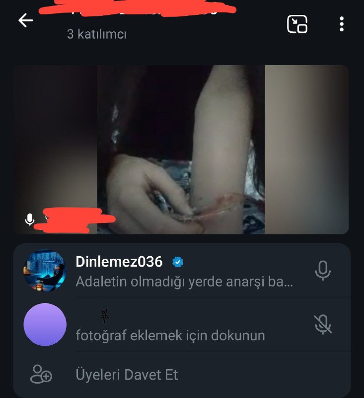 [@kapalicezaevi](https://t.me/kapalicezaevi) intahar yayını etkinliği ***😅***