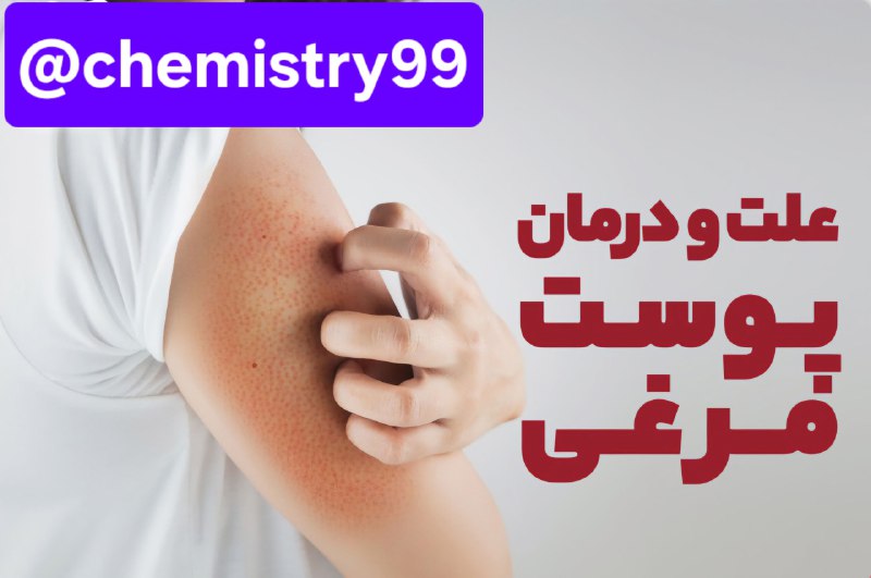 **علت پوست مرغی / کراتوز پیلاریس …