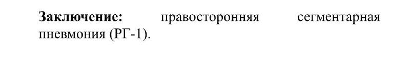 *она хотела бы жить на Манхэттене*****🥲****