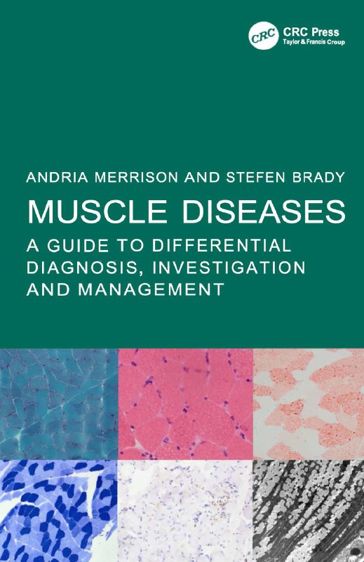 Muscle Diseases. A Guide to Differential …