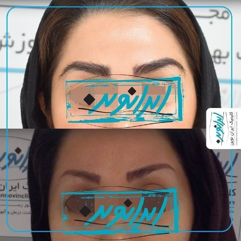 چهره‌ای جذاب‌تر با ابروهایی طبیعی!