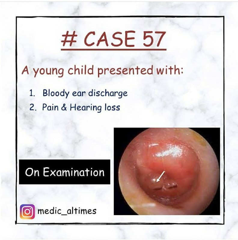 Clinical Cases