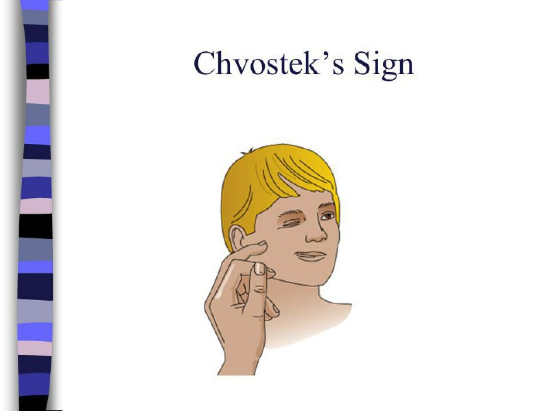 ***?*** Chvostek sign***?***