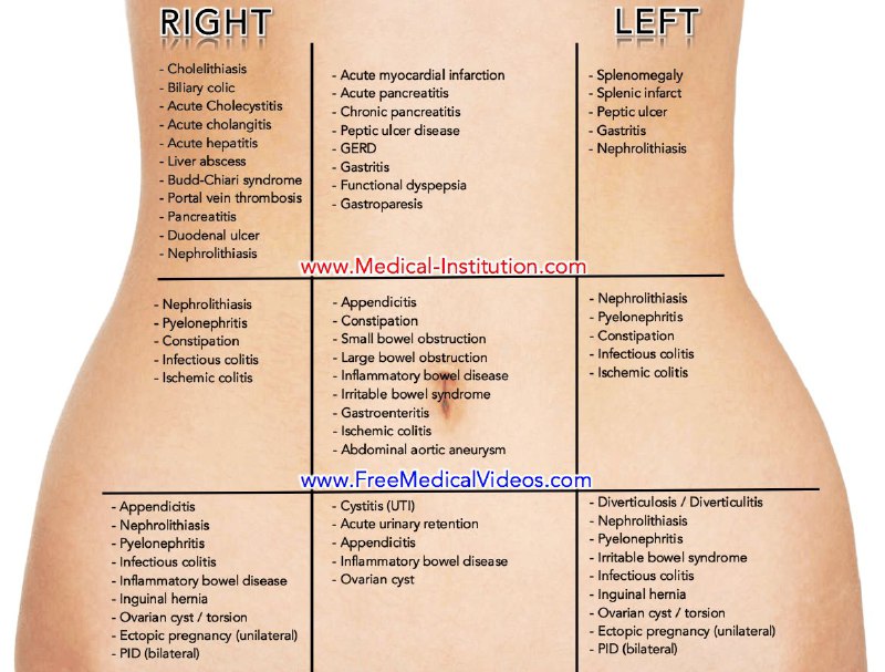 DDx of Pain according site in …