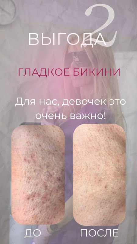 ЛАЗЕРНАЯ ЭПИЛЯЦИЯ ОДИНЦОВО МАССАЖ DANA.LABS