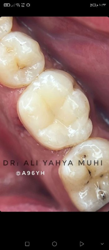 مُـستلزمَات طب الاسنان|🦷