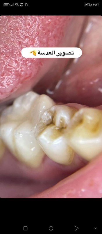 مُـستلزمَات طب الاسنان|🦷