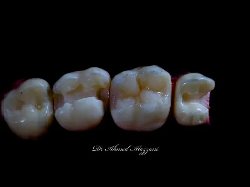 دورات طب الأسنان - اديسون