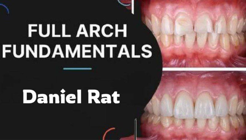 **Full Arch Fundamentals