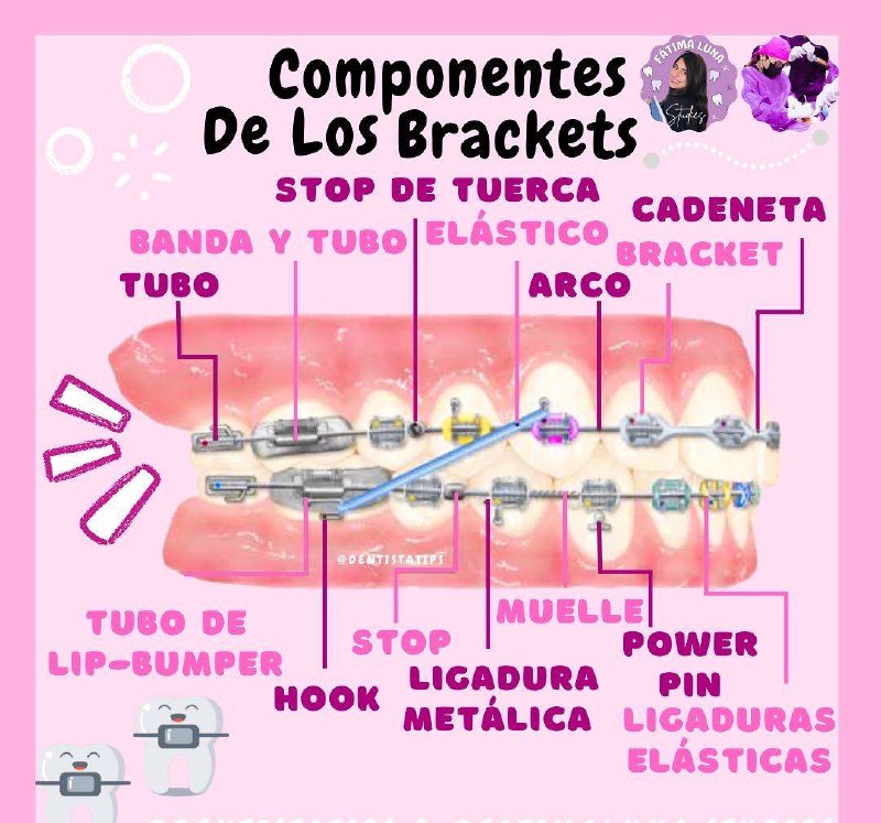 Component of brackets ***🩷******🦷***