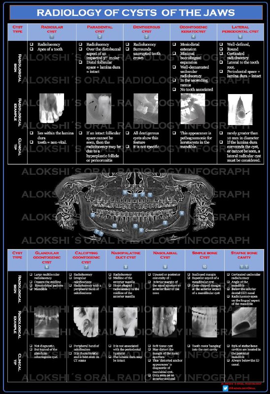 CYST JAW RADIOLOGY