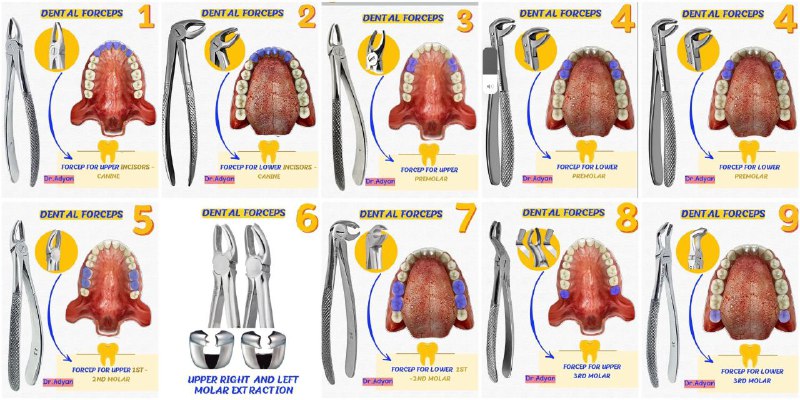 ملخصه لك الforceps بطريقة راااائعه***👏🏼***