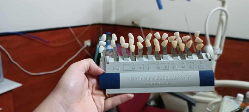Dentin Team ( 5 ) ?