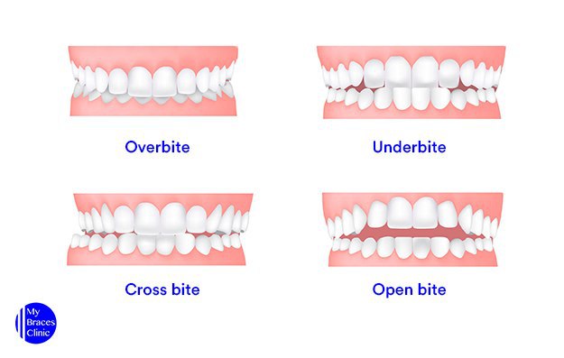 طب الأسنان المُبسّط