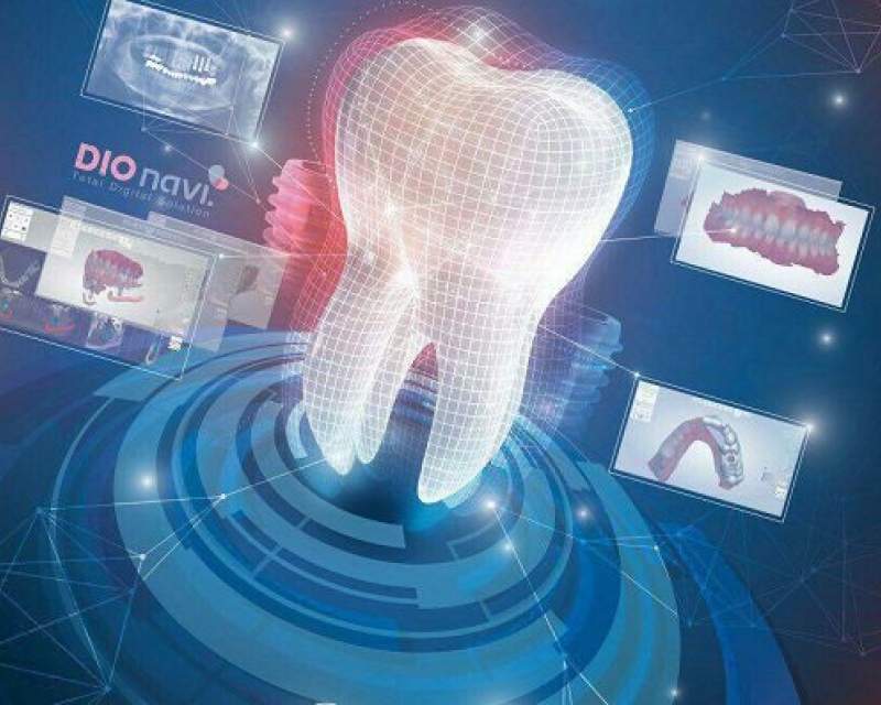 [**ورود دندانپزشکی به عرصه دیجیتال**](https://www.darmanna.ir/news/1234/%D9%88%D8%B1%D9%88%D8%AF-%D8%AF%D9%86%D8%AF%D8%A7%D9%86%D9%BE%D8%B2%D8%B4%DA%A9%DB%8C-%D8%B9%D8%B1%D8%B5%D9%87-%D8%AF%DB%8C%D8%AC%DB%8C%D8%AA%D8%A7%D9%84)