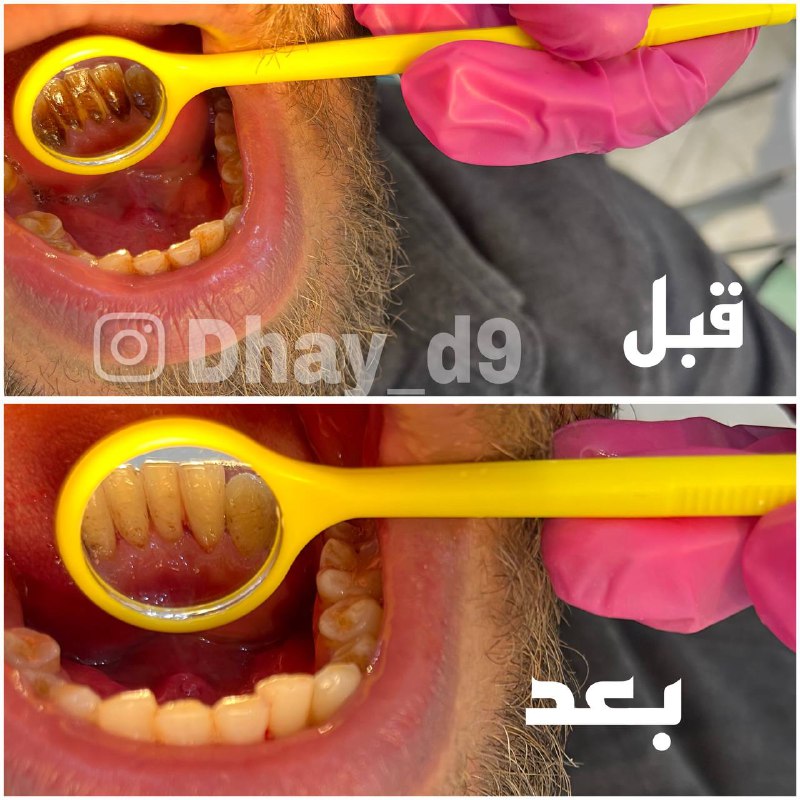 طب اسنان (ضي ماجد )2 -3-4
