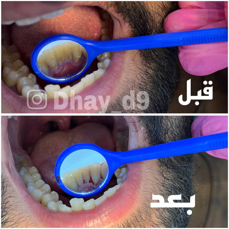 طب اسنان (ضي ماجد )2 -3-4
