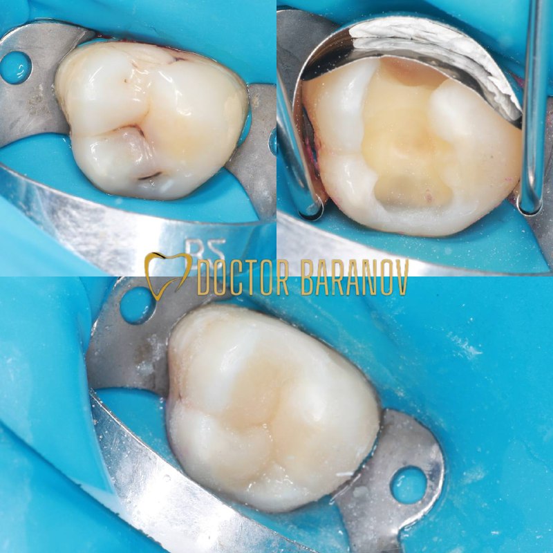 Зачем нужны врачу подробные фото [работ](https://t.me/doctor_baranov/2599) …