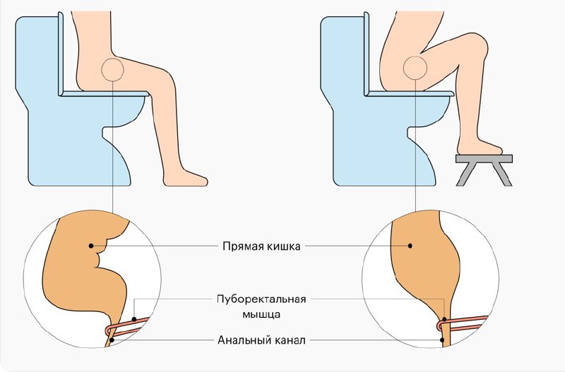 ***📍*****Полезный девайс для туалета**