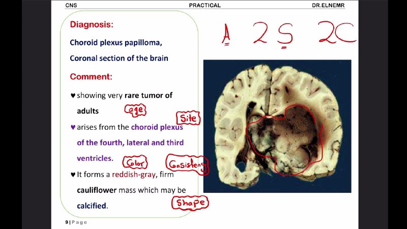 َDr Elnemr Pathology || 2nd year