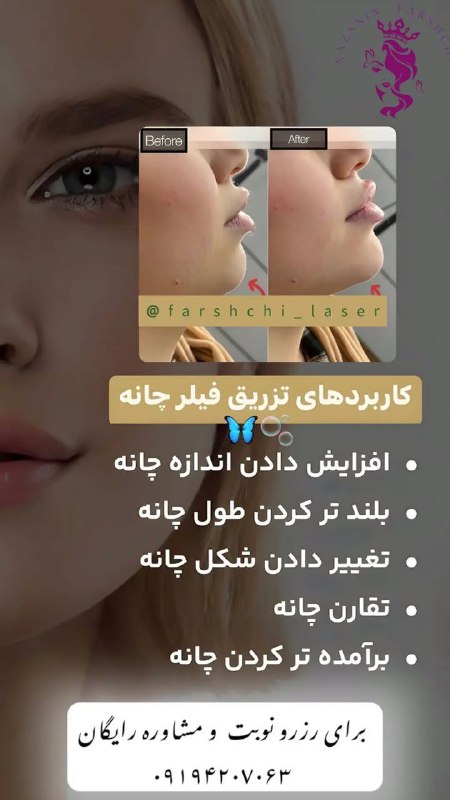 خدمات زیبایی پوست مو و لیزر …
