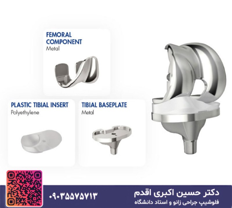 ***?***تعویض مجدد زانو