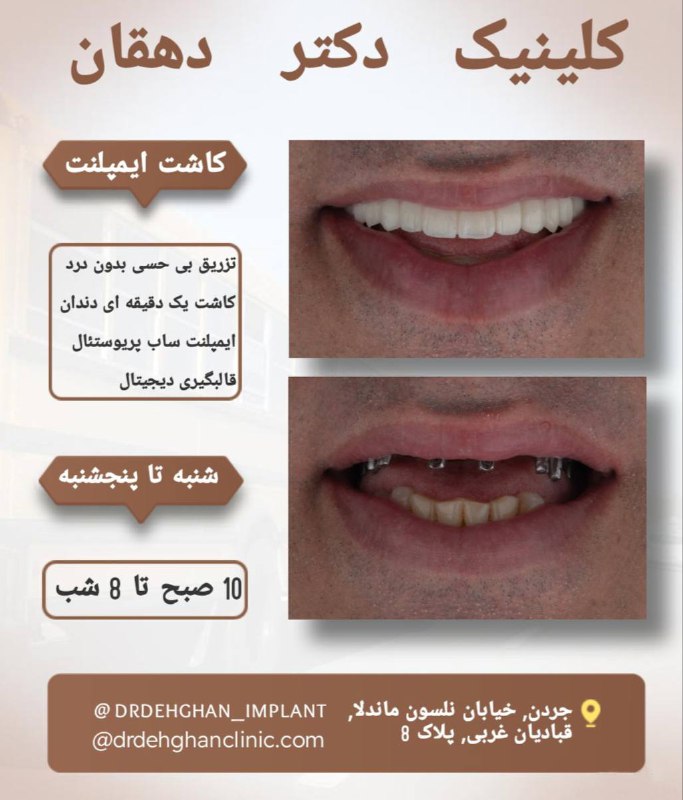 ***📌*** برای مشاوره و گرفتن نوبت، …