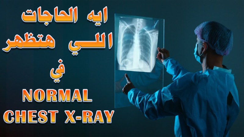 Dr Hossam Mokhtar IM Lectures